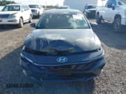 ✅ 2025 Hyundai Elantra SEL Convenience • VIN: KMHLS4DG0SU028975 • Lot: 43645484. Listed on IAAI with 13,552 mi. Free auction sales archive from the USA and detailed vehicle history report at DreamBid. Image 11.