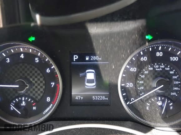 ✅ 2020 Hyundai Elantra SE • VIN: KMHD74LF5LU987613 • Лот: 43612260. Опубликован ранее на IAAI с пробегом 53 228 миль. Бесплатный доступ к архиву аукционных продаж из США и подробный отчёт об истории автомобиля на DreamBid. Изображение 15.