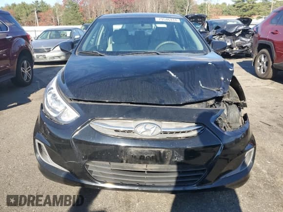 ✅ 2017 Hyundai Accent SE • VIN: KMHCT4AE4HU375153 • Лот: 79546444. Опубликован ранее на Copart с пробегом 100 158 миль. Бесплатный доступ к архиву аукционных продаж из США и подробный отчёт об истории автомобиля на DreamBid. Изображение 5.