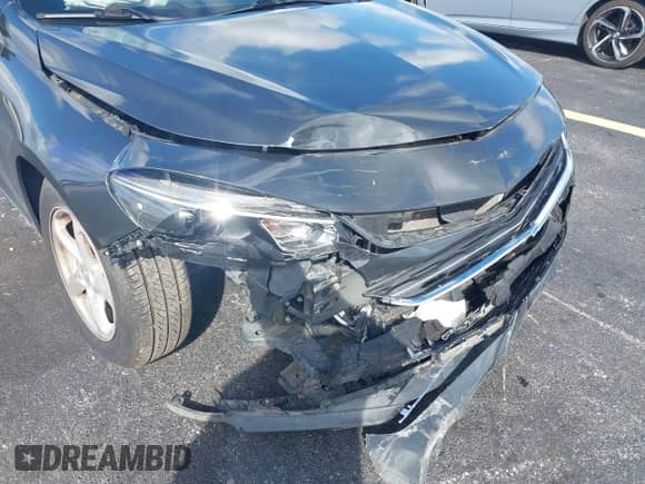 2018 Chevrolet Malibu LS with VIN 1G1ZB5ST2JF157350, listed as a IAAI auction lot 43504606 with 49,016 mi miles and . Bid and sale history available at DreamBid. Image 6.