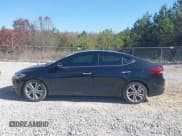 ✅ 2017 Hyundai Elantra Value Edition • VIN: 5NPD84LF2HH075315 • Lot: 43693492. Listed on IAAI with 115,217 mi. Free auction sales archive from the USA and detailed vehicle history report at DreamBid. Image 14.