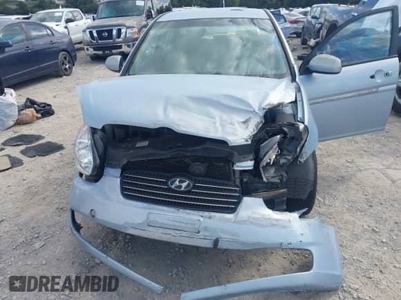 2011 Hyundai Accent GLS with VIN KMHCN4AC4BU615575, listed as a IAAI auction lot 43344413 with 222,302 mi miles and . Bid and sale history available at DreamBid. Image 6.