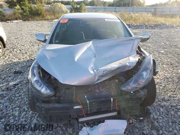 ✅ 2014 Hyundai Elantra Limited • VIN: 5NPDH4AE0EH457753 • Lot: 87434935. Listed on Copart with Not provided. Free auction sales archive from the USA and detailed vehicle history report at DreamBid. Image 5.