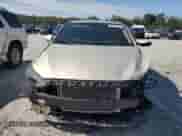 2017 Hyundai Elantra Value Edition with VIN 5NPD84LF4HH171687, listed as a Copart auction lot 83950815 with 60,314 mi miles and Salvage title. Bid and sale history available at DreamBid. Image 5.