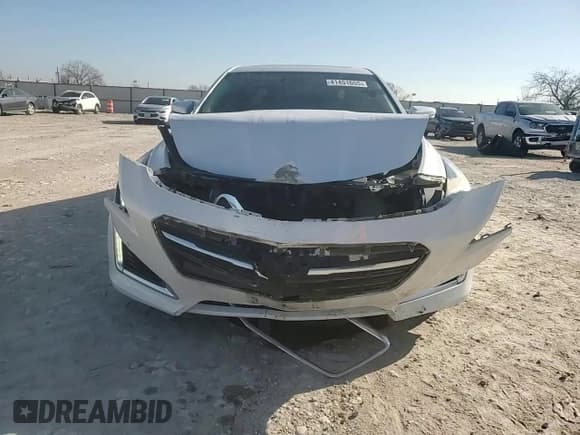 ✅ 2015 Cadillac CTS Premium RWD • VIN: 1G6AT5S3XF0136342 • Лот: 41451655. Опубликован ранее на Copart с пробегом 156 640 миль. Бесплатный доступ к архиву аукционных продаж из США и подробный отчёт об истории автомобиля на DreamBid. Изображение 11.