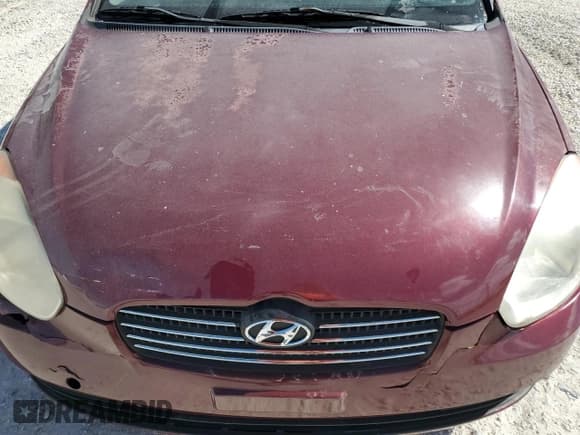 ✅ 2010 Hyundai Accent GLS • VIN: KMHCN4AC8AU431786 • Лот: 68863465. Опубликован ранее на Copart с пробегом Не указан. Бесплатный доступ к архиву аукционных продаж из США и подробный отчёт об истории автомобиля на DreamBid. Изображение 11.