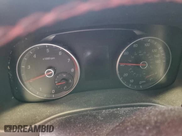 ✅ 2017 Hyundai Elantra Sport • VIN: KMHD04LB6HU315391 • Lot: 58931665. Listed on Copart with Not provided. Free auction sales archive from the USA and detailed vehicle history report at DreamBid. Image 9.