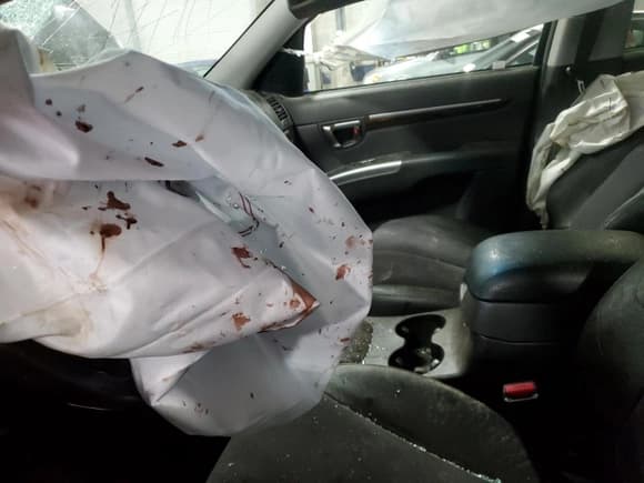 ✅ 2011 Hyundai Santa Fe SE • VIN: 5XYZHDAG0BG011063 • Lot: 68551274. Listed on Copart with 153,011 mi. Free auction sales archive from the USA and detailed vehicle history report at DreamBid. Image 7.