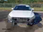 2018 Hyundai Elantra Value Edition с VIN 5NPD84LF1JH267038, выставлен на аукционе IAAI как лот 43446405 с пробегом 181 524 миль миль и . История ставок и продаж доступна на DreamBid. Изображение 13.