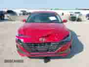 2022 Hyundai Elantra Limited с VIN 5NPLP4AG5NH083818, выставлен на аукционе IAAI как лот 43215071 с пробегом 57 288 миль миль и . История ставок и продаж доступна на DreamBid. Изображение 12.