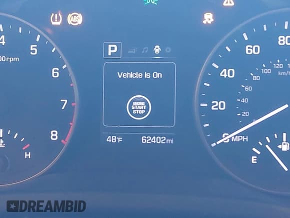 ✅ 2017 Hyundai Elantra SE • VIN: 5NPD84LF1HH071921 • Lot: 43399547. Listed on IAAI with 62,402 mi. Free auction sales archive from the USA and detailed vehicle history report at DreamBid. Image 15.