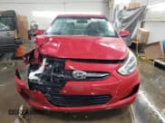 ✅ 2017 Hyundai Accent SE • VIN: KMHCT4AE9HU339278 • Лот: 79748404. Опубликован ранее на Copart с пробегом 49 937 миль. Бесплатный доступ к архиву аукционных продаж из США и подробный отчёт об истории автомобиля на DreamBid. Изображение 5.