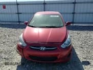 ✅ 2017 Hyundai Accent SE • VIN: KMHCT4AE7HU200766 • Лот: 50281304. Опубликован ранее на Copart с пробегом 154 298 миль. Бесплатный доступ к архиву аукционных продаж из США и подробный отчёт об истории автомобиля на DreamBid. Изображение 11.