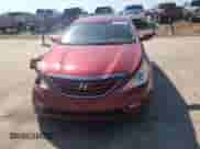 2013 Hyundai Sonata GLS z VIN 5NPEB4AC0DH509143, wystawiony jako Copart lot #82179565 z przebiegiem 155 247 mil mil oraz Szkoda całkowita • Salvage title. Historia ofert i sprzedaży dostępna na DreamBid. Obrazek 13.