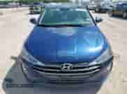 2020 Hyundai Elantra SE z VIN 5NPD74LF1LH611568, wystawiony jako Copart lot #81816075 z przebiegiem 55 950 mil mil oraz Szkoda całkowita • Salvage title. Historia ofert i sprzedaży dostępna na DreamBid. Obrazek 5.
