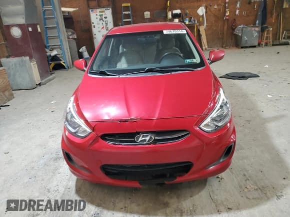 ✅ 2016 Hyundai Accent SE • VIN: KMHCT4AEXGU986125 • Лот: 74670314. Опубликован ранее на Copart с пробегом 164 330 миль. Бесплатный доступ к архиву аукционных продаж из США и подробный отчёт об истории автомобиля на DreamBid. Изображение 5.