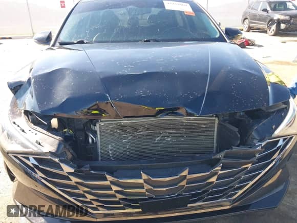 2021 Hyundai Elantra Limited with VIN 5NPLP4AG3MH027553, listed as a IAAI auction lot 43452869 with 39,175 mi miles and . Bid and sale history available at DreamBid. Image 6.