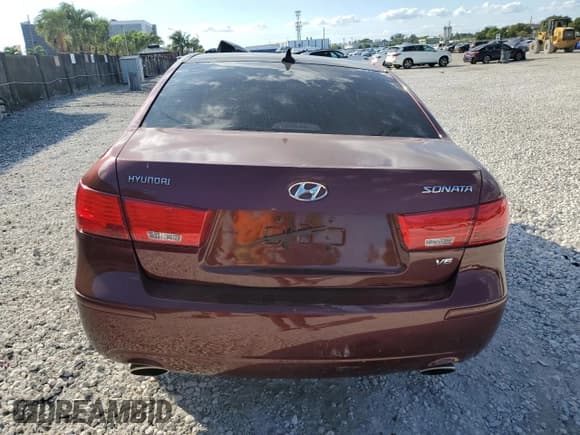 ✅ 2009 Hyundai Sonata GLS • VIN: 5NPET46F49H406427 • Лот: 90608595. Опубликован ранее на Copart с пробегом 138 154 миль. Бесплатный доступ к архиву аукционных продаж из США и подробный отчёт об истории автомобиля на DreamBid. Изображение 6.