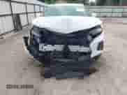 2020 Chevrolet Blazer RS z VIN 3GNKBERS8LS591025, wystawiony jako IAAI lot #43026312 z przebiegiem 58 380 mil mil oraz . Historia ofert i sprzedaży dostępna na DreamBid. Obrazek 6.