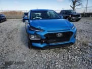 ✅ 2021 Hyundai Kona SE • VIN: KM8K1CAA6MU604841 • Лот: 77482353. Опубликован ранее на Copart с пробегом 56 659 миль. Бесплатный доступ к архиву аукционных продаж из США и подробный отчёт об истории автомобиля на DreamBid. Изображение 11.