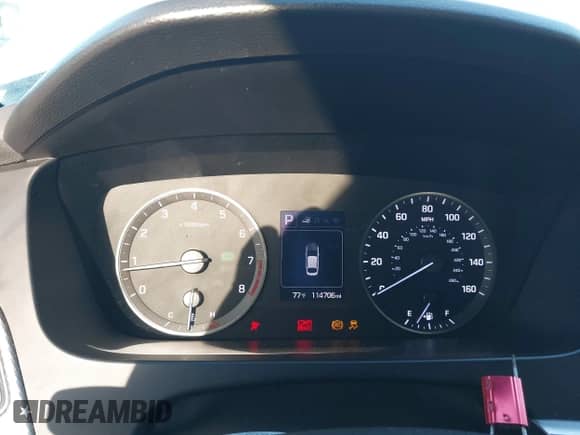 2015 Hyundai Sonata SE z VIN 5NPE24AF3FH132305, wystawiony jako IAAI lot #43336839 z przebiegiem 114 706 mil mil oraz . Historia ofert i sprzedaży dostępna na DreamBid. Obrazek 7.