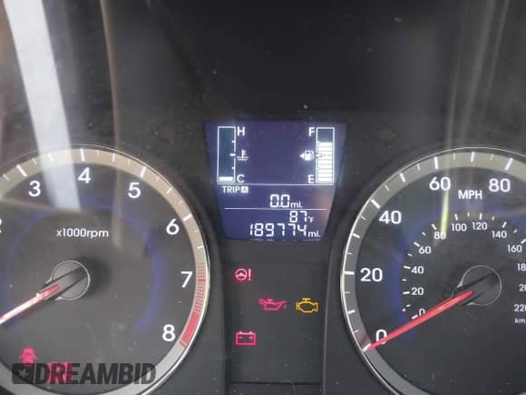 ✅ 2015 Hyundai Accent Sport • VIN: KMHCU5AE5FU201477 • Lot: 41529347. Listed on IAAI with 189,774 mi miles. Access the free auction sales archive from the USA and view a detailed vehicle history report at DreamBid. Image 12.