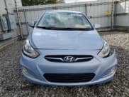 ✅ 2013 Hyundai Accent GLS • VIN: KMHCU4AEXDU310749 • Лот: 75617964. Опубликован ранее на Copart с пробегом 99 999 миль. Бесплатный доступ к архиву аукционных продаж из США и подробный отчёт об истории автомобиля на DreamBid. Изображение 5.