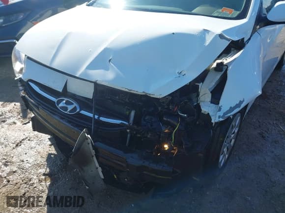 ✅ 2016 Hyundai Accent GL • VIN: KMHCT5AE4GU236936 • Лот: 41620676. Опубликован ранее на IAAI с пробегом 101 400 миль. Бесплатный доступ к архиву аукционных продаж из США и подробный отчёт об истории автомобиля на DreamBid. Изображение 6.