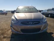 ✅ 2012 Hyundai Accent SE • VIN: KMHCU5AE3CU017666 • Лот: 75546844. Опубликован ранее на Copart с пробегом 139 039 миль. Бесплатный доступ к архиву аукционных продаж из США и подробный отчёт об истории автомобиля на DreamBid. Изображение 5.